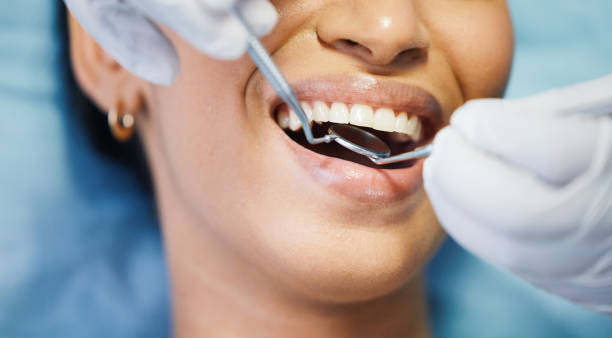 Best Emergency Dental Services for Seniors in Lakemont, PA